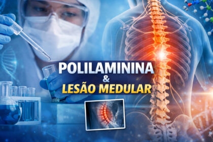 Infográfico científico com o título "POLILAMININA & LESÃO MEDULAR". À esquerda, um pesquisador usando máscara e óculos de proteção manipula tubos de ensaio em um laboratório. À direita, uma ilustração anatômica do tronco humano destaca a coluna vertebral com um ponto brilhante em laranja, simbolizando uma lesão. Há também uma pequena imagem de raio-X detalhando a área afetada na coluna.